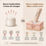 ScarStick™ | Für Aknenarben, OP-Narben & Dehnungsstreifen. Klinisch wirksam für zu Hause