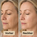 PeelShot™ | Exfolierende Reis-Ampulle für Poren & Glow