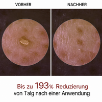 PeelShot™ | Exfolierende Reis-Ampulle für Poren & Glow