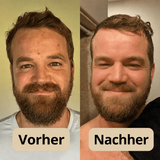 PeelShot™ | Exfolierende Reis-Ampulle für Poren & Glow