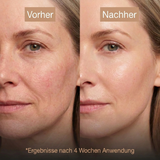 Koreanische Anti-Aging-Creme